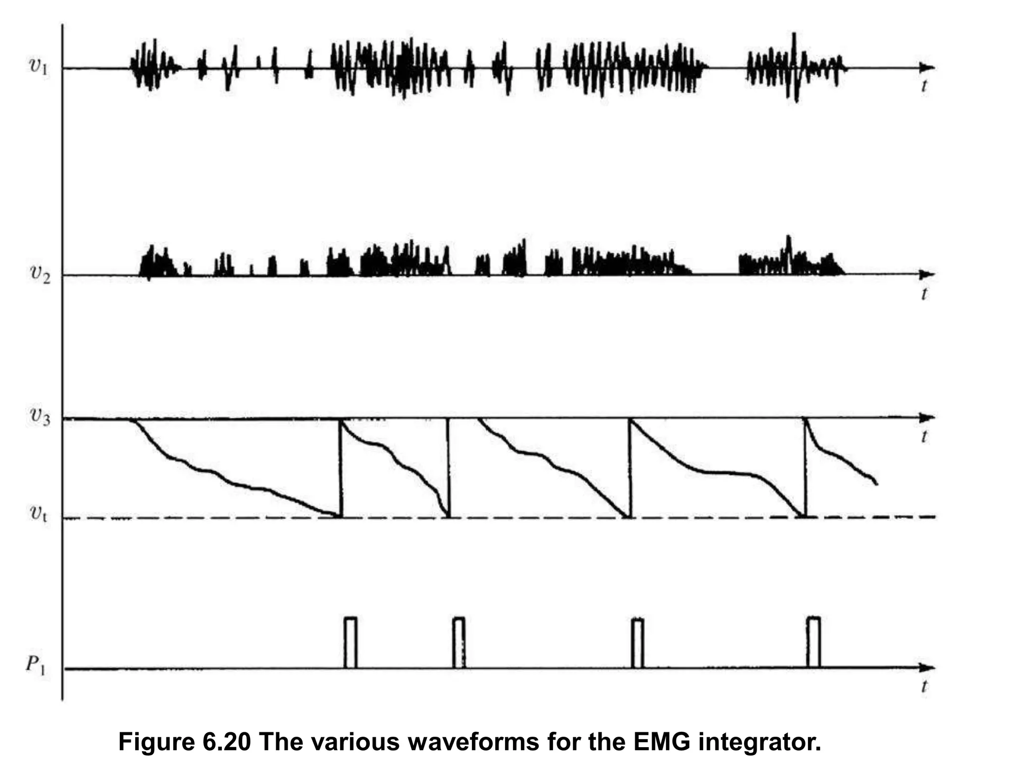 Figure 6.20 The various waveforms for the EMG integrator.
 