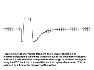 Figure 6.8 Effect of a voltage transient on an ECG recorded on an
electrocardiograph in which the transient causes the amplifier to saturate,
and a finite period of time is required for the charge to bleed off enough to
bring the ECG back into the amplifier's active region of operation. This is
followed by a first-order recovery of the system.
 