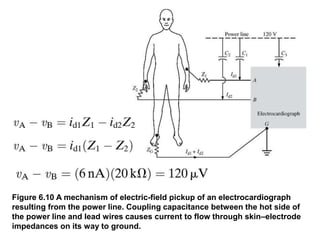 Figure 6.10 A mechanism of electric-field pickup of an electrocardiograph
resulting from the power line. Coupling capacitance between the hot side of
the power line and lead wires causes current to flow through skin–electrode
impedances on its way to ground.
 