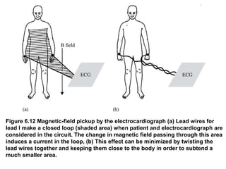 Figure 6.12 Magnetic-field pickup by the electrocardiograph (a) Lead wires for
lead I make a closed loop (shaded area) when patient and electrocardiograph are
considered in the circuit. The change in magnetic field passing through this area
induces a current in the loop, (b) This effect can be minimized by twisting the
lead wires together and keeping them close to the body in order to subtend a
much smaller area.
 