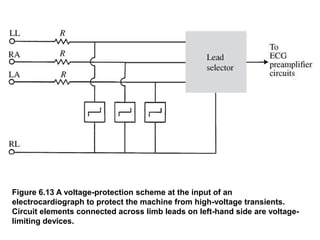Figure 6.13 A voltage-protection scheme at the input of an
electrocardiograph to protect the machine from high-voltage transients.
Circuit elements connected across limb leads on left-hand side are voltage-
limiting devices.
 