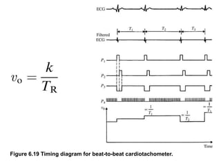 Figure 6.19 Timing diagram for beat-to-beat cardiotachometer.
 