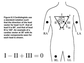 Figure 6.3 Cardiologists use
a standard notation such
that the direction of the lead
vector for lead I is 0°, that of
lead II is 60°, and that of lead
III is 120°. An example of a
cardiac vector at 30° with its
scalar components seen for
each lead is shown.
 