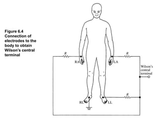 Figure 6.4
Connection of
electrodes to the
body to obtain
Wilson’s central
terminal
 