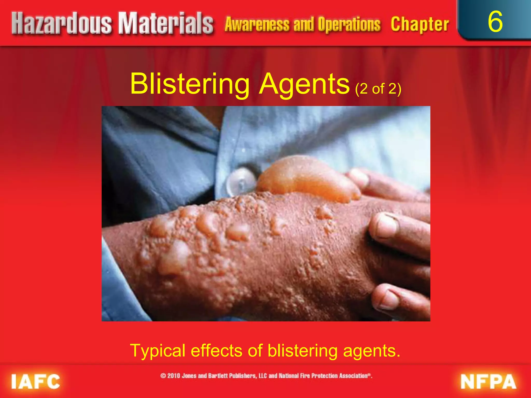 6

Blistering Agents (2 of 2)




Typical effects of blistering agents.
 