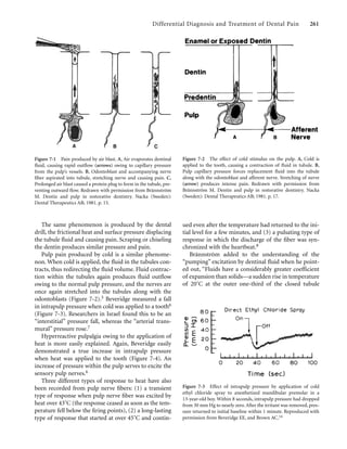 Differential Diagnosis and Treatment of Dental Pain 261
The same phenomenon is produced by the dental
drill, the frictional heat and surface pressure displacing
the tubule ﬂuid and causing pain. Scraping or chiseling
the dentin produces similar pressure and pain.
Pulp pain produced by cold is a similar phenome-
non. When cold is applied, the ﬂuid in the tubules con-
tracts, thus redirecting the ﬂuid volume. Fluid contrac-
tion within the tubules again produces ﬂuid outﬂow
owing to the normal pulp pressure, and the nerves are
once again stretched into the tubules along with the
odontoblasts (Figure 7-2).5 Beveridge measured a fall
in intrapulp pressure when cold was applied to a tooth6
(Figure 7-3). Researchers in Israel found this to be an
“interstitial” pressure fall, whereas the “arterial trans-
mural” pressure rose.7
Hyperreactive pulpalgia owing to the application of
heat is more easily explained. Again, Beveridge easily
demonstrated a true increase in intrapulp pressure
when heat was applied to the tooth (Figure 7-4). An
increase of pressure within the pulp serves to excite the
sensory pulp nerves.6
Three different types of response to heat have also
been recorded from pulp nerve ﬁbers: (1) a transient
type of response when pulp nerve ﬁber was excited by
heat over 43˚C (the response ceased as soon as the tem-
perature fell below the ﬁring points), (2) a long-lasting
type of response that started at over 45˚C and contin-
ued even after the temperature had returned to the ini-
tial level for a few minutes, and (3) a pulsating type of
response in which the discharge of the ﬁber was syn-
chronized with the heartbeat.8
Brännström added to the understanding of the
“pumping” excitation by dentinal ﬂuid when he point-
ed out, “Fluids have a considerably greater coefficient
of expansion than solids—a sudden rise in temperature
of 20˚C at the outer one-third of the closed tubule
Figure 7-1 Pain produced by air blast. A, Air evaporates dentinal
ﬂuid, causing rapid outﬂow (arrows) owing to capillary pressure
from the pulp’s vessels. B, Odontoblast and accompanying nerve
ﬁber aspirated into tubule, stretching nerve and causing pain. C,
Prolonged air blast caused a protein plug to form in the tubule, pre-
venting outward ﬂow. Redrawn with permission from Brännström
M. Dentin and pulp in restorative dentistry. Nacka (Sweden):
Dental Therapeutics AB; 1981. p. 15.
Figure 7-2 The effect of cold stimulus on the pulp. A, Cold is
applied to the tooth, causing a contraction of ﬂuid in tubule. B,
Pulp capillary pressure forces replacement ﬂuid into the tubule
along with the odontoblast and afferent nerve. Stretching of nerve
(arrow) produces intense pain. Redrawn with permission from
Brännström M. Dentin and pulp in restorative dentistry. Nacka
(Sweden): Dental Therapeutics AB; 1981. p. 17.
Figure 7-3 Effect of intrapulp pressure by application of cold
ethyl chloride spray to anesthetized mandibular premolar in a
13-year-old boy. Within 8 seconds, intrapulp pressure had dropped
from 30 mm Hg to nearly zero. After the irritant was removed, pres-
sure returned to initial baseline within 1 minute. Reproduced with
permission from Beveridge EE, and Brown AC.14
 