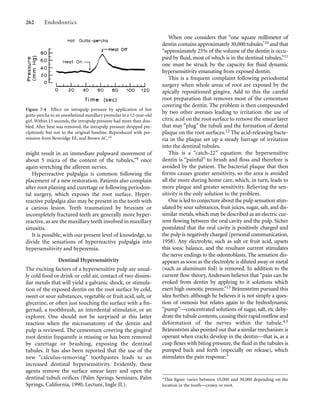 might result in an immediate pulpward movement of
about 5 micra of the content of the tubules,”9 once
again stretching the afferent nerves.
Hyperreactive pulpalgia is common following the
placement of a new restoration. Patients also complain
after root planing and curettage or following periodon-
tal surgery, which exposes the root surface. Hyper-
reactive pulpalgia also may be present in the tooth with
a carious lesion. Teeth traumatized by bruxism or
incompletely fractured teeth are generally more hyper-
reactive, as are the maxillary teeth involved in maxillary
sinusitis.
It is possible, with our present level of knowledge, to
divide the sensations of hyperreactive pulpalgia into
hypersensitivity and hyperemia.
Dentinal Hypersensitivity
The exciting factors of a hypersensitive pulp are usual-
ly cold food or drink or cold air, contact of two dissim-
ilar metals that will yield a galvanic shock, or stimula-
tion of the exposed dentin on the root surface by cold,
sweet or sour substances, vegetable or fruit acid, salt, or
glycerine, or often just touching the surface with a ﬁn-
gernail, a toothbrush, an interdental stimulator, or an
explorer. One should not be surprised at this latter
reaction when the microanatomy of the dentin and
pulp is reviewed. The cementum covering the gingival
root dentin frequently is missing or has been removed
by curettage or brushing, exposing the dentinal
tubules. It has also been reported that the use of the
new “calculus-removing” toothpastes leads to an
increased dentinal hypersensitivity. Evidently, these
agents remove the surface smear layer and open the
dentinal tubuli oriﬁces (Palm Springs Seminars, Palm
Springs, California, 1990, Lecture, Ingle JI.).
262 Endodontics
When one considers that “one square millimeter of
dentin contains approximately 30,000 tubules*10 and that
“approximately 25% of the volume of the dentin is occu-
pied by ﬂuid, most of which is in the dentinal tubules,”11
one must be struck by the capacity for ﬂuid dynamic
hypersensitivity emanating from exposed dentin.
This is a frequent complaint following periodontal
surgery when whole areas of root are exposed by the
apically repositioned gingiva. Add to this the careful
root preparation that removes most of the cementum
covering the dentin. The problem is then compounded
by two other avenues leading to irritation: the use of
citric acid on the root surface to remove the smear layer
that may “plug” the tubuli and the formation of dental
plaque on the root surfaces.12 The acid-releasing bacte-
ria in the plaque set up a steady barrage of irritation
into the dentinal tubules.
This is a “catch-22” equation: the hypersensitive
dentin is “painful” to brush and ﬂoss and therefore is
avoided by the patient. The bacterial plaque that then
forms causes greater sensitivity, so the area is avoided
all the more during home care, which, in turn, leads to
more plaque and greater sensitivity. Relieving the sen-
sitivity is the only solution to the problem.
One is led to conjecture about the pulp sensation stim-
ulated by sour substances, fruit juices, sugar, salt, and dis-
similar metals, which may be described as an electric cur-
rent ﬂowing between the oral cavity and the pulp. Sicher
postulated that the oral cavity is positively charged and
the pulp is negatively charged (personal communication,
1958). Any electrolyte, such as salt or fruit acid, upsets
this ionic balance, and the resultant current stimulates
the nerve endings to the odontoblasts. The sensation dis-
appears as soon as the electrolyte is diluted away or metal
(such as aluminum foil) is removed. In addition to the
current ﬂow theory, Anderson believes that “pain can be
evoked from dentin by applying to it solutions which
exert high osmotic pressure.”13 Brännström pursued this
idea further, although he believes it is not simply a ques-
tion of osmosis but relates again to the hydrodynamic
“pump”—concentrated solutions of sugar, salt, etc dehy-
drate the tubule contents,causing their rapid outﬂow and
deformation of the nerves within the tubule.4,5
Brännström also pointed out that a similar mechanism is
operant when cracks develop in the dentin—that is, as a
cusp ﬂexes with biting pressure, the ﬂuid in the tubules is
pumped back and forth (especially on release), which
stimulates the pain response.5
*This ﬁgure varies between 10,000 and 30,000 depending on the
location in the tooth—crown or root.
Figure 7-4 Effect on intrapulp pressure by application of hot
gutta-percha to an anesthetized maxillary premolar in a 12-year-old
girl. Within 15 seconds, the intrapulp pressure had more than dou-
bled. After heat was removed, the intrapulp pressure dropped pre-
cipitously but not to the original baseline. Reproduced with per-
mission from Beveridge EE, and Brown AC.14
 