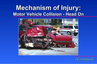 Mechanism of Injury: Motor Vehicle Collision - Head On (Continued) 