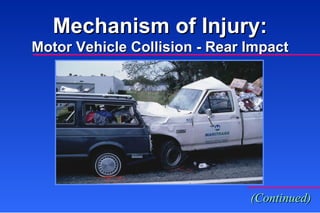 Mechanism of Injury: Motor Vehicle Collision - Rear Impact (Continued) 