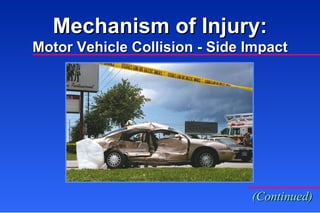 Mechanism of Injury: Motor Vehicle Collision - Side Impact (Continued) 
