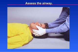 Assess the airway. 