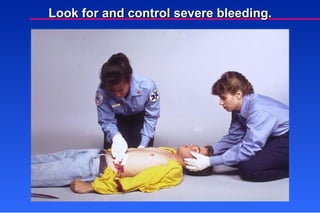 Look for and control severe bleeding. 