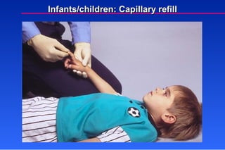 Infants/children: Capillary refill 