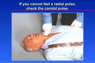 If you cannot feel a radial pulse, check the carotid pulse. 