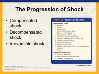 The Progression of Shock
• Compensated
shock
• Decompensated
shock
• Irreversible shock
© Jones & Bartlett Learning.
 