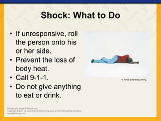 Shock: What to Do
• If unresponsive, roll
the person onto his
or her side.
• Prevent the loss of
body heat.
• Call 9-1-1.
• Do not give anything
to eat or drink.
© Jones & Bartlett Learning.
 