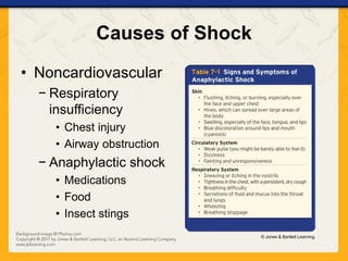 Causes of Shock
• Noncardiovascular
− Respiratory
insufficiency
• Chest injury
• Airway obstruction
− Anaphylactic shock
• Medications
• Food
• Insect stings
© Jones & Bartlett Learning.
 