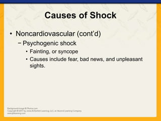 Causes of Shock
• Noncardiovascular (cont’d)
− Psychogenic shock
• Fainting, or syncope
• Causes include fear, bad news, and unpleasant
sights.
 