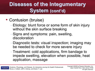 Copyright ©2009 by Pearson Education, Inc.
Upper Saddle River, New Jersey 07458
All rights reserved.
Anatomy, Physiology, and Disease: An Interactive Journey for Health Professionals
Bruce J. Colbert, Jeff E. Ankney, and Karen T. Lee
Diseases of the Integumentary
System (cont’d)
• Contusion (bruise)
–Etiology: blunt force or some form of skin injury
without the skin surface breaking
–Signs and symptoms: pain, swelling,
discoloration
–Diagnostic tests: visual inspection; imaging may
be needed to check for more severe injury
–Treatment: cold applications, firm bandage to
impede swelling, elevation when possible, heat
application, massage
 