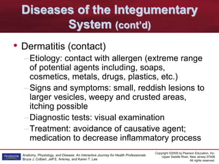 Copyright ©2009 by Pearson Education, Inc.
Upper Saddle River, New Jersey 07458
All rights reserved.
Anatomy, Physiology, and Disease: An Interactive Journey for Health Professionals
Bruce J. Colbert, Jeff E. Ankney, and Karen T. Lee
Diseases of the Integumentary
System (cont’d)
• Dermatitis (contact)
–Etiology: contact with allergen (extreme range
of potential agents including, soaps,
cosmetics, metals, drugs, plastics, etc.)
–Signs and symptoms: small, reddish lesions to
larger vesicles, weepy and crusted areas,
itching possible
–Diagnostic tests: visual examination
–Treatment: avoidance of causative agent;
medication to decrease inflammatory process
 