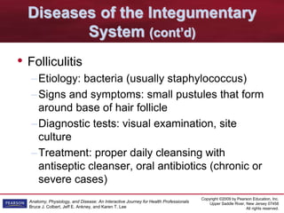 Copyright ©2009 by Pearson Education, Inc.
Upper Saddle River, New Jersey 07458
All rights reserved.
Anatomy, Physiology, and Disease: An Interactive Journey for Health Professionals
Bruce J. Colbert, Jeff E. Ankney, and Karen T. Lee
Diseases of the Integumentary
System (cont’d)
• Folliculitis
–Etiology: bacteria (usually staphylococcus)
–Signs and symptoms: small pustules that form
around base of hair follicle
–Diagnostic tests: visual examination, site
culture
–Treatment: proper daily cleansing with
antiseptic cleanser, oral antibiotics (chronic or
severe cases)
 