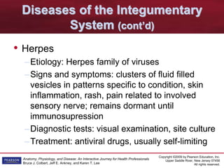 Copyright ©2009 by Pearson Education, Inc.
Upper Saddle River, New Jersey 07458
All rights reserved.
Anatomy, Physiology, and Disease: An Interactive Journey for Health Professionals
Bruce J. Colbert, Jeff E. Ankney, and Karen T. Lee
Diseases of the Integumentary
System (cont’d)
• Herpes
–Etiology: Herpes family of viruses
–Signs and symptoms: clusters of fluid filled
vesicles in patterns specific to condition, skin
inflammation, rash, pain related to involved
sensory nerve; remains dormant until
immunosupression
–Diagnostic tests: visual examination, site culture
–Treatment: antiviral drugs, usually self-limiting
 