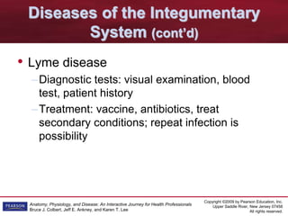 Copyright ©2009 by Pearson Education, Inc.
Upper Saddle River, New Jersey 07458
All rights reserved.
Anatomy, Physiology, and Disease: An Interactive Journey for Health Professionals
Bruce J. Colbert, Jeff E. Ankney, and Karen T. Lee
Diseases of the Integumentary
System (cont’d)
• Lyme disease
–Diagnostic tests: visual examination, blood
test, patient history
–Treatment: vaccine, antibiotics, treat
secondary conditions; repeat infection is
possibility
 