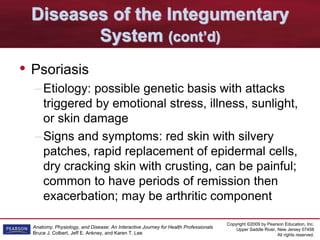 Copyright ©2009 by Pearson Education, Inc.
Upper Saddle River, New Jersey 07458
All rights reserved.
Anatomy, Physiology, and Disease: An Interactive Journey for Health Professionals
Bruce J. Colbert, Jeff E. Ankney, and Karen T. Lee
Diseases of the Integumentary
System (cont’d)
• Psoriasis
–Etiology: possible genetic basis with attacks
triggered by emotional stress, illness, sunlight,
or skin damage
–Signs and symptoms: red skin with silvery
patches, rapid replacement of epidermal cells,
dry cracking skin with crusting, can be painful;
common to have periods of remission then
exacerbation; may be arthritic component
 