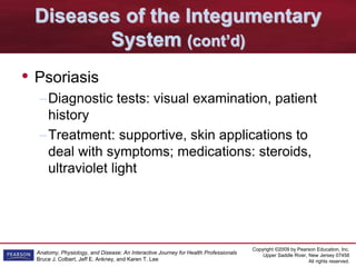 Copyright ©2009 by Pearson Education, Inc.
Upper Saddle River, New Jersey 07458
All rights reserved.
Anatomy, Physiology, and Disease: An Interactive Journey for Health Professionals
Bruce J. Colbert, Jeff E. Ankney, and Karen T. Lee
Diseases of the Integumentary
System (cont’d)
• Psoriasis
–Diagnostic tests: visual examination, patient
history
–Treatment: supportive, skin applications to
deal with symptoms; medications: steroids,
ultraviolet light
 