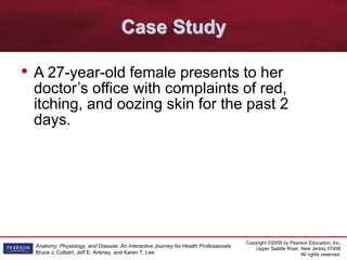 Copyright ©2009 by Pearson Education, Inc.
Upper Saddle River, New Jersey 07458
All rights reserved.
Anatomy, Physiology, and Disease: An Interactive Journey for Health Professionals
Bruce J. Colbert, Jeff E. Ankney, and Karen T. Lee
Case Study
• A 27-year-old female presents to her
doctor’s office with complaints of red,
itching, and oozing skin for the past 2
days.
 