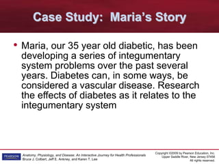 Copyright ©2009 by Pearson Education, Inc.
Upper Saddle River, New Jersey 07458
All rights reserved.
Anatomy, Physiology, and Disease: An Interactive Journey for Health Professionals
Bruce J. Colbert, Jeff E. Ankney, and Karen T. Lee
Case Study: Maria’s Story
• Maria, our 35 year old diabetic, has been
developing a series of integumentary
system problems over the past several
years. Diabetes can, in some ways, be
considered a vascular disease. Research
the effects of diabetes as it relates to the
integumentary system
 