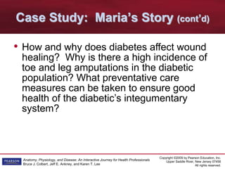 Copyright ©2009 by Pearson Education, Inc.
Upper Saddle River, New Jersey 07458
All rights reserved.
Anatomy, Physiology, and Disease: An Interactive Journey for Health Professionals
Bruce J. Colbert, Jeff E. Ankney, and Karen T. Lee
Case Study: Maria’s Story (cont’d)
• How and why does diabetes affect wound
healing? Why is there a high incidence of
toe and leg amputations in the diabetic
population? What preventative care
measures can be taken to ensure good
health of the diabetic’s integumentary
system?
 