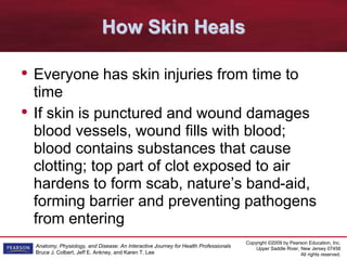 Copyright ©2009 by Pearson Education, Inc.
Upper Saddle River, New Jersey 07458
All rights reserved.
Anatomy, Physiology, and Disease: An Interactive Journey for Health Professionals
Bruce J. Colbert, Jeff E. Ankney, and Karen T. Lee
How Skin Heals
• Everyone has skin injuries from time to
time
• If skin is punctured and wound damages
blood vessels, wound fills with blood;
blood contains substances that cause
clotting; top part of clot exposed to air
hardens to form scab, nature’s band-aid,
forming barrier and preventing pathogens
from entering
 