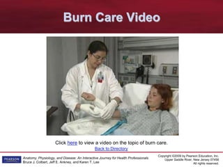 Copyright ©2009 by Pearson Education, Inc.
Upper Saddle River, New Jersey 07458
All rights reserved.
Anatomy, Physiology, and Disease: An Interactive Journey for Health Professionals
Bruce J. Colbert, Jeff E. Ankney, and Karen T. Lee
Click here to view a video on the topic of burn care.
Burn Care Video
Back to Directory
 