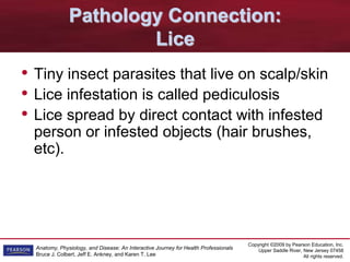 Copyright ©2009 by Pearson Education, Inc.
Upper Saddle River, New Jersey 07458
All rights reserved.
Anatomy, Physiology, and Disease: An Interactive Journey for Health Professionals
Bruce J. Colbert, Jeff E. Ankney, and Karen T. Lee
Pathology Connection:
Lice
• Tiny insect parasites that live on scalp/skin
• Lice infestation is called pediculosis
• Lice spread by direct contact with infested
person or infested objects (hair brushes,
etc).
 