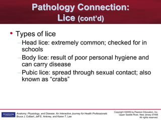 Copyright ©2009 by Pearson Education, Inc.
Upper Saddle River, New Jersey 07458
All rights reserved.
Anatomy, Physiology, and Disease: An Interactive Journey for Health Professionals
Bruce J. Colbert, Jeff E. Ankney, and Karen T. Lee
Pathology Connection:
Lice (cont’d)
• Types of lice
–Head lice: extremely common; checked for in
schools
–Body lice: result of poor personal hygiene and
can carry disease
–Pubic lice: spread through sexual contact; also
known as “crabs”
 
