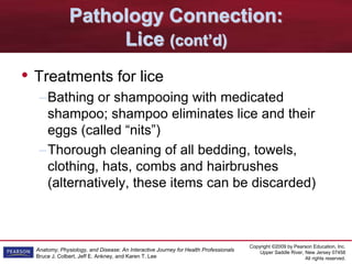 Copyright ©2009 by Pearson Education, Inc.
Upper Saddle River, New Jersey 07458
All rights reserved.
Anatomy, Physiology, and Disease: An Interactive Journey for Health Professionals
Bruce J. Colbert, Jeff E. Ankney, and Karen T. Lee
Pathology Connection:
Lice (cont’d)
• Treatments for lice
–Bathing or shampooing with medicated
shampoo; shampoo eliminates lice and their
eggs (called “nits”)
–Thorough cleaning of all bedding, towels,
clothing, hats, combs and hairbrushes
(alternatively, these items can be discarded)
 