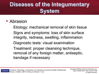 Copyright ©2009 by Pearson Education, Inc.
Upper Saddle River, New Jersey 07458
All rights reserved.
Anatomy, Physiology, and Disease: An Interactive Journey for Health Professionals
Bruce J. Colbert, Jeff E. Ankney, and Karen T. Lee
Diseases of the Integumentary
System
• Abrasion
–Etiology: mechanical removal of skin tissue
–Signs and symptoms: loss of skin surface
integrity, redness, swelling, inflammation
–Diagnostic tests: visual examination
–Treatment: proper cleansing technique,
removal of any foreign matter, antiseptic,
bandage if necessary
 
