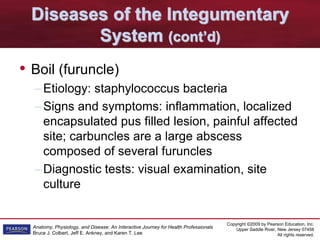 Copyright ©2009 by Pearson Education, Inc.
Upper Saddle River, New Jersey 07458
All rights reserved.
Anatomy, Physiology, and Disease: An Interactive Journey for Health Professionals
Bruce J. Colbert, Jeff E. Ankney, and Karen T. Lee
Diseases of the Integumentary
System (cont’d)
• Boil (furuncle)
–Etiology: staphylococcus bacteria
–Signs and symptoms: inflammation, localized
encapsulated pus filled lesion, painful affected
site; carbuncles are a large abscess
composed of several furuncles
–Diagnostic tests: visual examination, site
culture
 