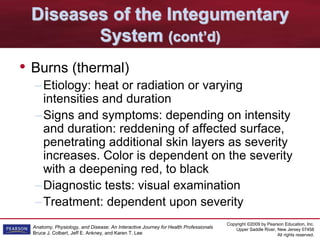 Copyright ©2009 by Pearson Education, Inc.
Upper Saddle River, New Jersey 07458
All rights reserved.
Anatomy, Physiology, and Disease: An Interactive Journey for Health Professionals
Bruce J. Colbert, Jeff E. Ankney, and Karen T. Lee
Diseases of the Integumentary
System (cont’d)
• Burns (thermal)
–Etiology: heat or radiation or varying
intensities and duration
–Signs and symptoms: depending on intensity
and duration: reddening of affected surface,
penetrating additional skin layers as severity
increases. Color is dependent on the severity
with a deepening red, to black
–Diagnostic tests: visual examination
–Treatment: dependent upon severity
 