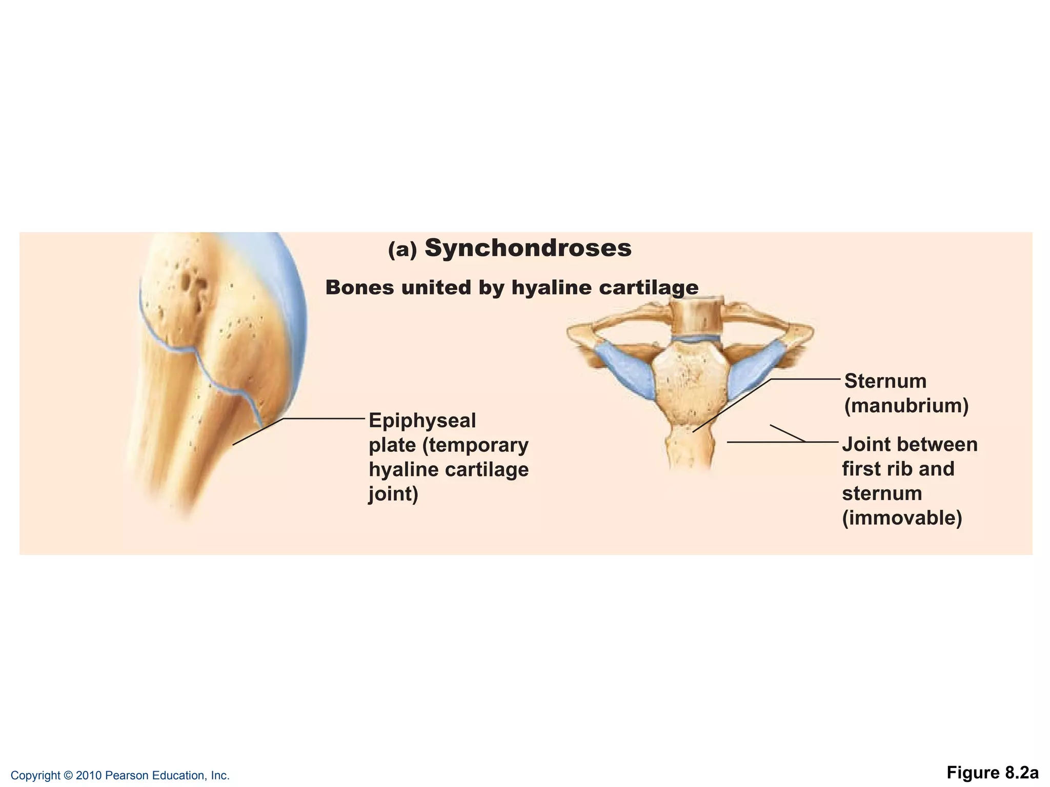 Figure 8.2a Epiphyseal plate (temporary hyaline cartilage joint) Sternum (manubrium) Joint between first rib and sternum (immovable) (a)  Synchondroses Bones united by hyaline cartilage 