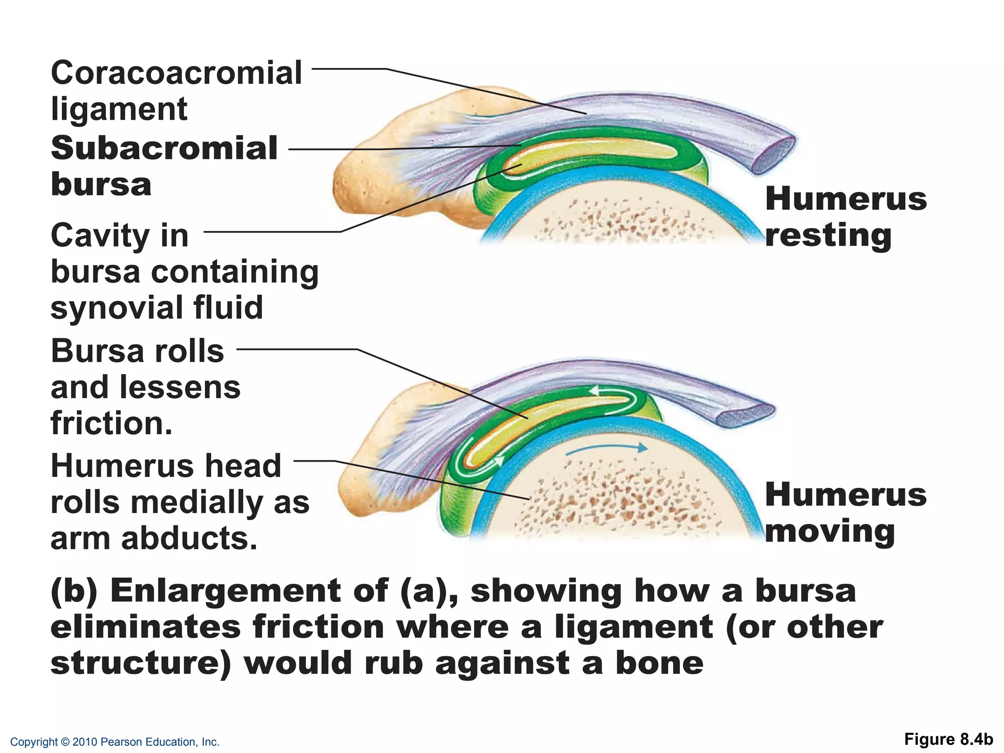 Figure 8.4b Coracoacromial ligament Subacromial bursa Cavity in bursa containing synovial fluid Bursa rolls and lessens friction. Humerus head rolls medially as arm abducts. (b) Enlargement of (a), showing how a bursa eliminates friction where a ligament (or other structure) would rub against a bone Humerus resting  Humerus moving 