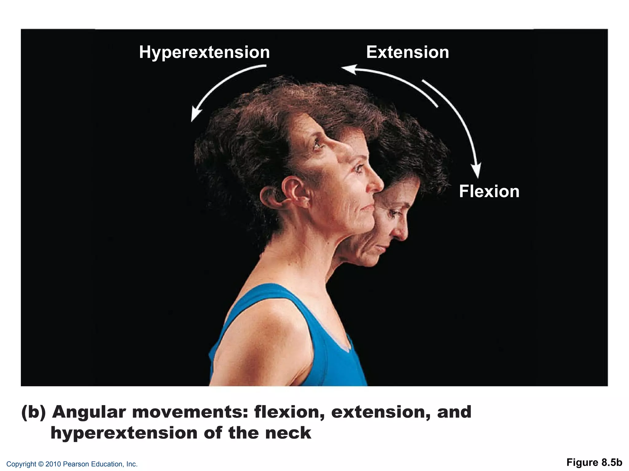 Figure 8.5b (b) Angular movements: flexion, extension, and hyperextension of the neck Hyperextension Extension Flexion 