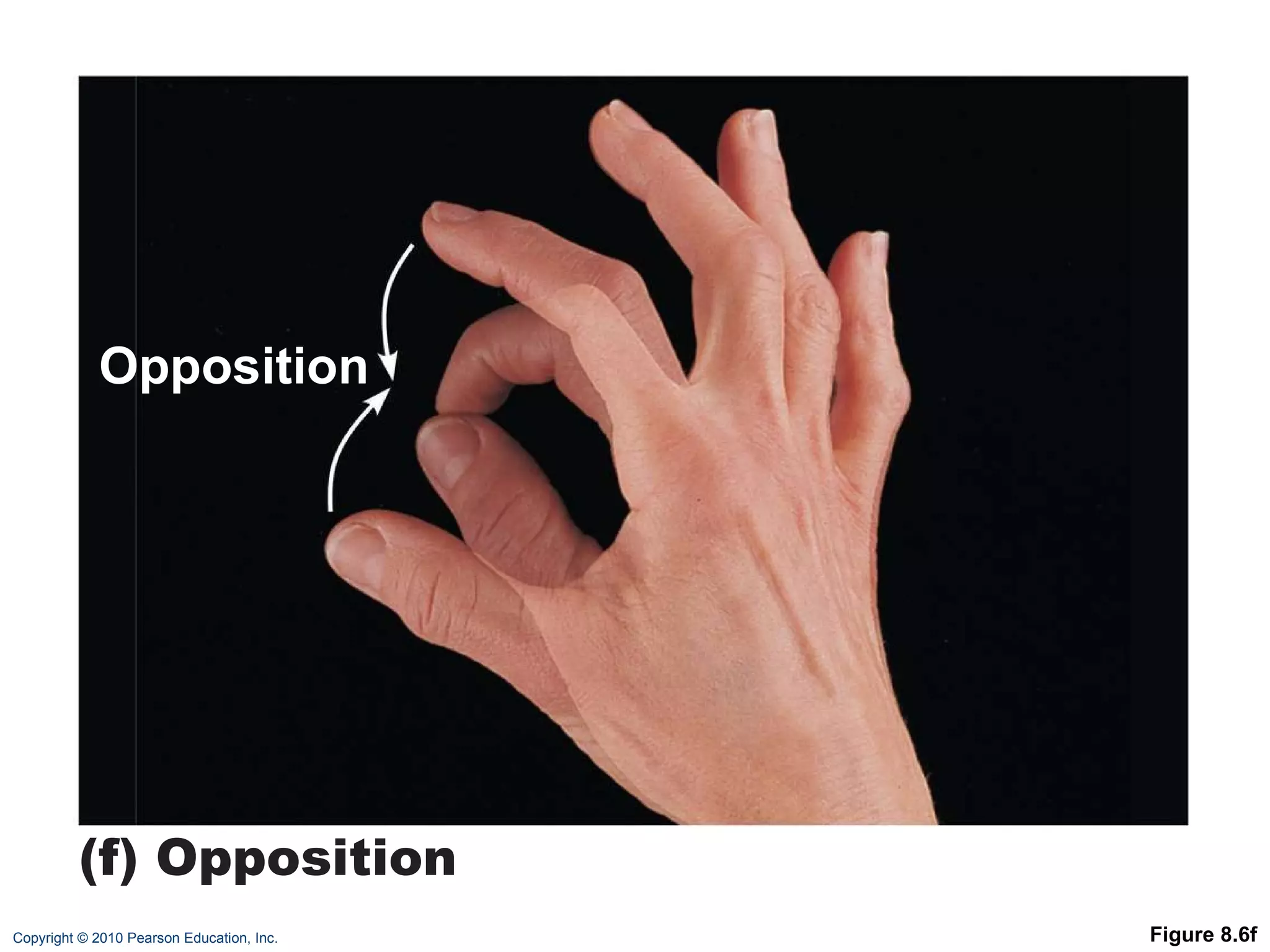 Figure 8.6f (f) Opposition Opposition 