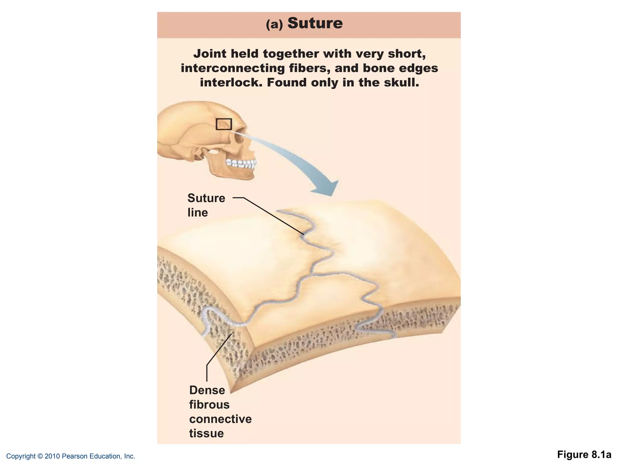 Figure 8.1a Dense fibrous connective tissue Suture line (a)  Suture   Joint held together with very short, interconnecting fibers, and bone edges interlock. Found only in the skull. 