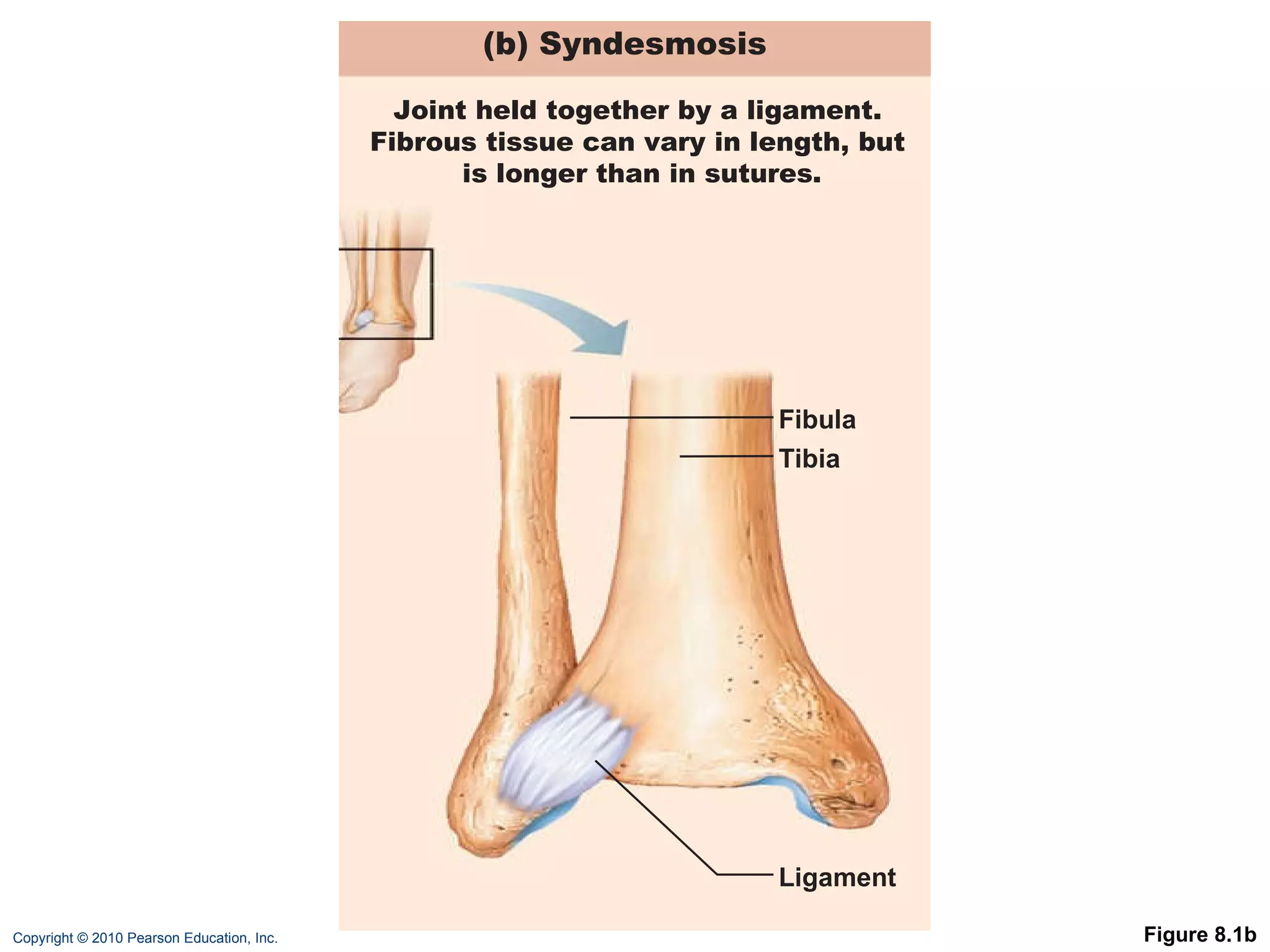 Figure 8.1b Fibula Tibia Ligament (b) Syndesmosis  Joint held together by a ligament. Fibrous tissue can vary in length, but is longer than in sutures. 