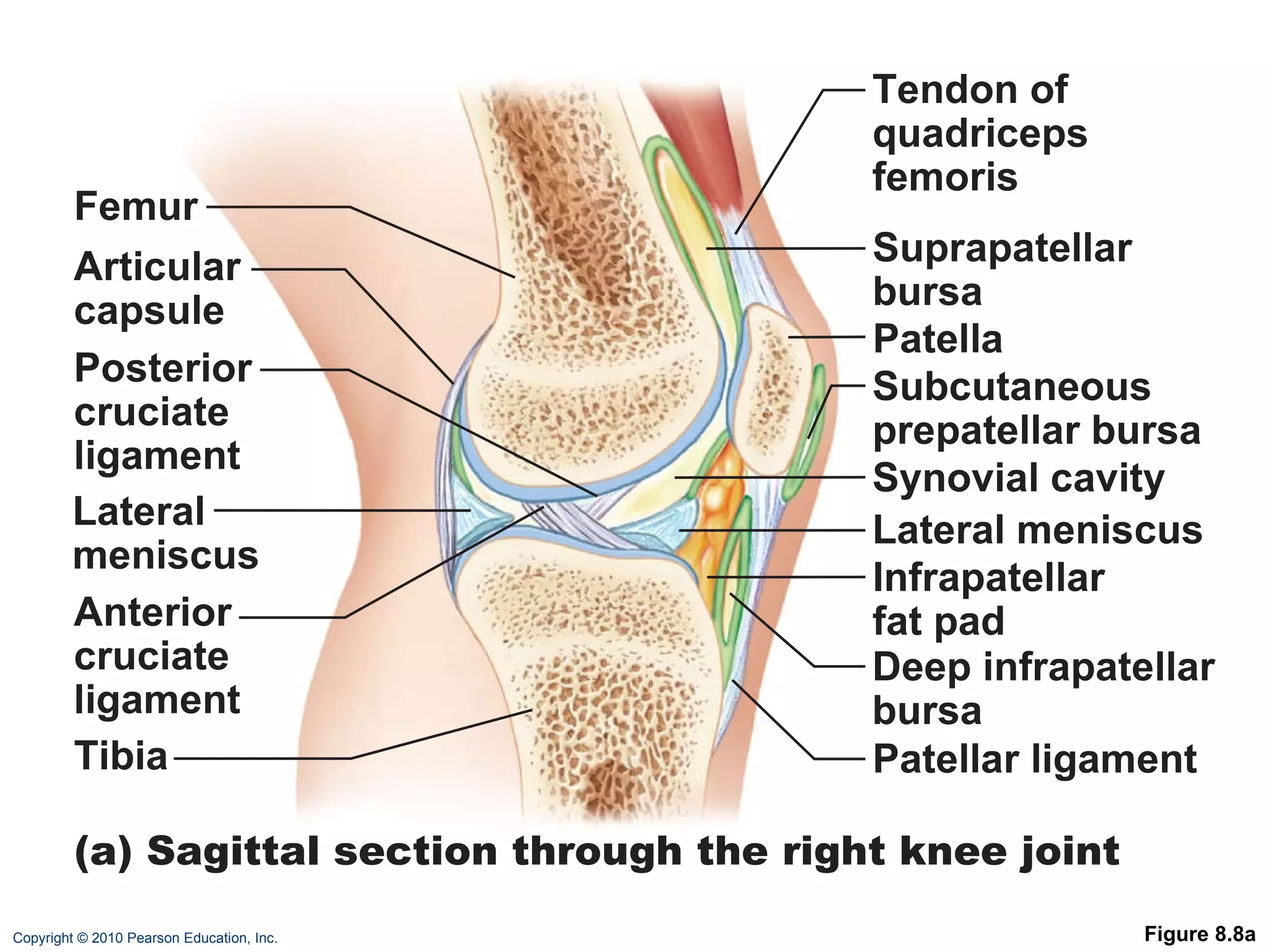 Figure 8.8a (a) Sagittal section through the right knee joint Femur Tendon of quadriceps femoris Suprapatellar bursa Patella Subcutaneous prepatellar bursa Synovial cavity Lateral meniscus Posterior cruciate ligament Infrapatellar fat pad  Deep infrapatellar bursa Patellar ligament Articular capsule Lateral meniscus Anterior cruciate ligament Tibia 