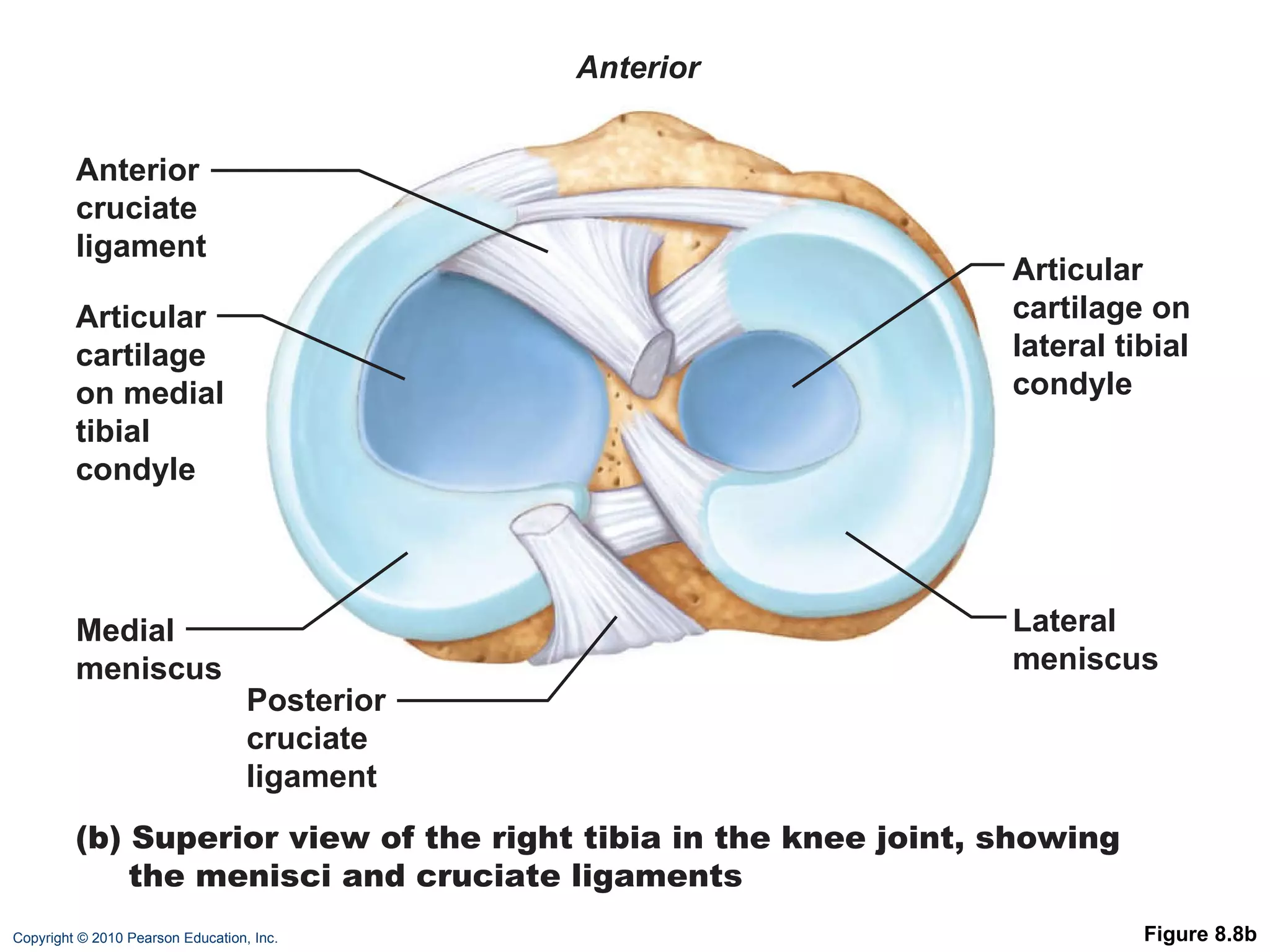 Figure 8.8b (b) Superior view of the right tibia in the knee joint, showing the menisci and cruciate ligaments Medial meniscus Articular cartilage on medial tibial condyle Anterior Anterior cruciate ligament Articular cartilage on lateral tibial condyle Lateral meniscus Posterior cruciate ligament 