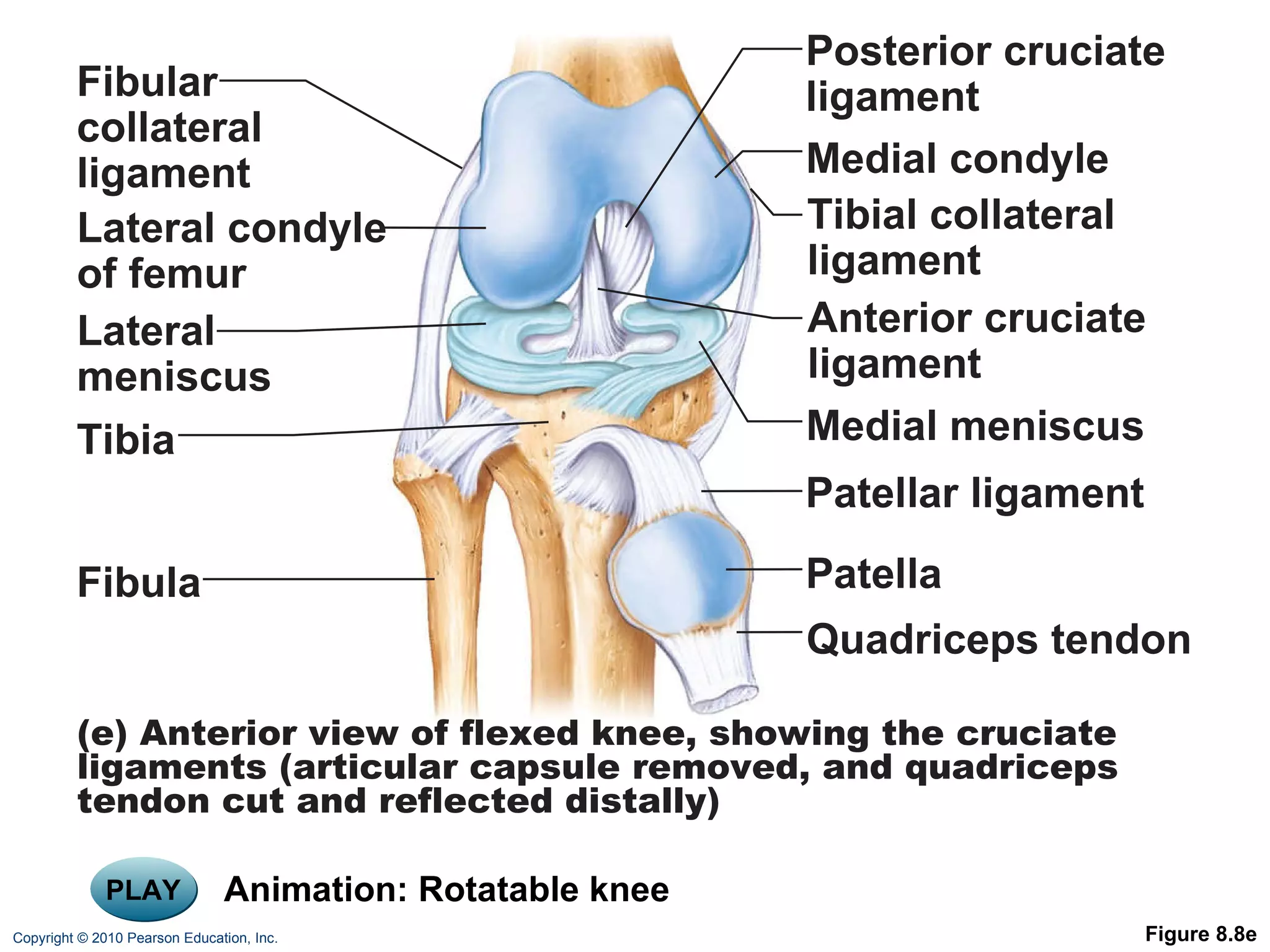 PLAY Animation: Rotatable knee Figure 8.8e Fibular collateral ligament Posterior cruciate ligament Medial condyle Tibial collateral ligament Anterior cruciate ligament Medial meniscus Patellar ligament Patella Quadriceps tendon Lateral condyle of femur Lateral meniscus Fibula Tibia (e) Anterior view of flexed knee, showing the cruciate ligaments (articular capsule removed, and quadriceps tendon cut and reflected distally) 