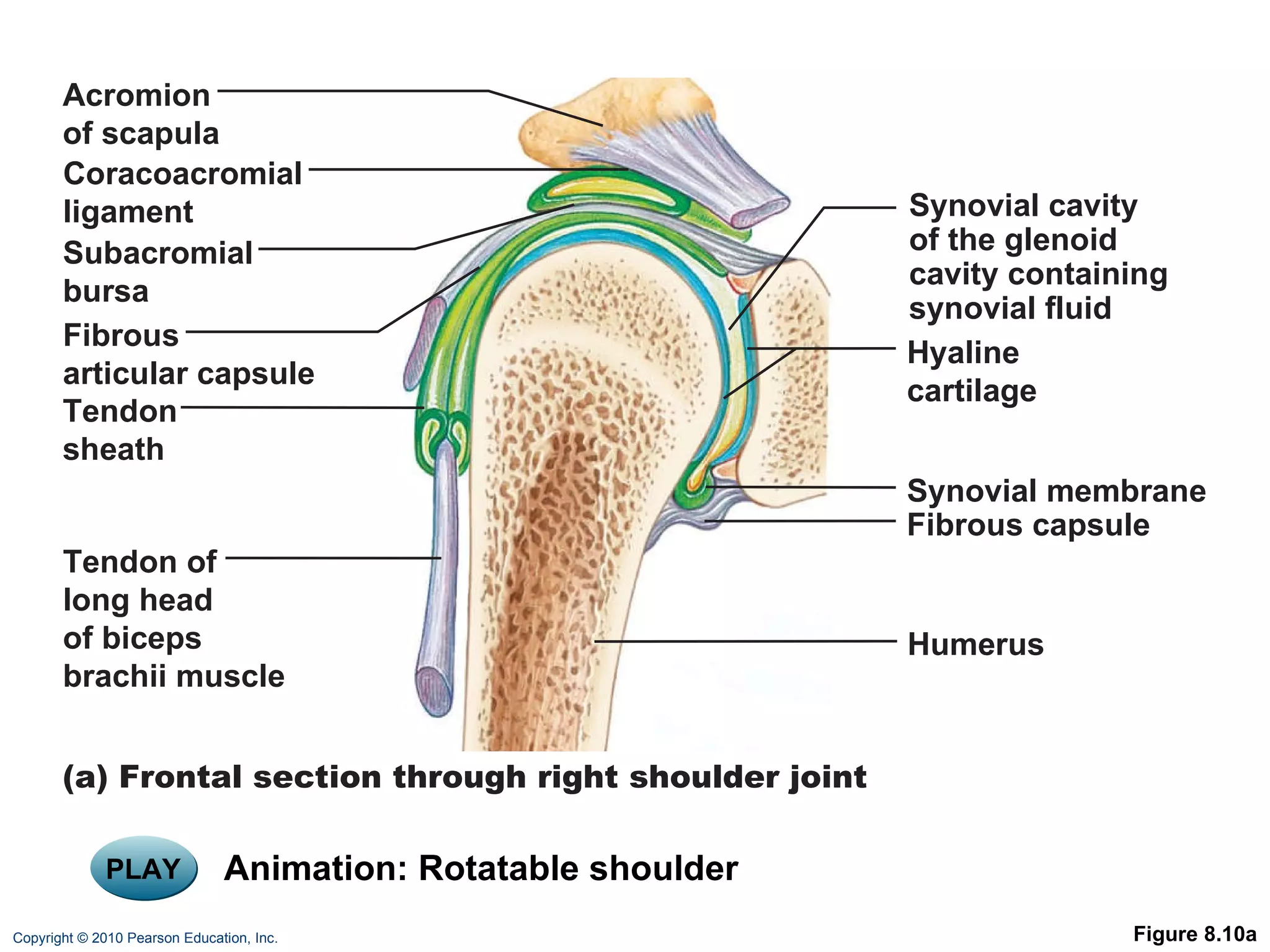 Figure 8.10a PLAY Animation: Rotatable shoulder Acromion of scapula Synovial membrane Fibrous capsule Hyaline cartilage Coracoacromial ligament Subacromial bursa Fibrous articular capsule Tendon sheath Tendon of long head of biceps brachii muscle Synovial cavity of the glenoid cavity containing synovial fluid Humerus (a) Frontal section through right shoulder joint 